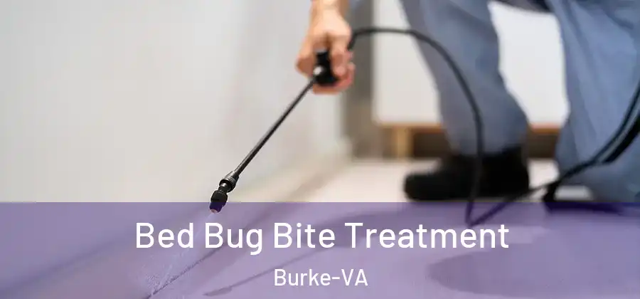 Bed Bug Bite Treatment Burke-VA